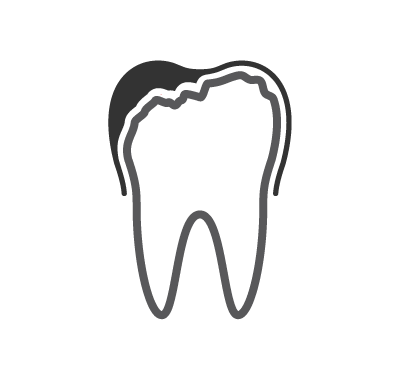 Dental Crowns